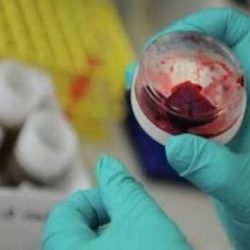 “الصحة” تتجه لإلزام شركات التأمين بدفع تكاليف علاج 5 ملايين مواطن بالمستشفيات الحكومية