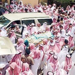 بدء عملية فصل التوأم السيامي اليمني “عبدالعزيز وعبدالله”