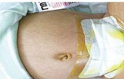 5 فرق تسيطر على حريق في الدمام