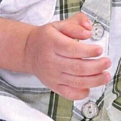 “صحة القصيم” تشكل لجنة للتحقيق في وفاة “امرأة حامل”