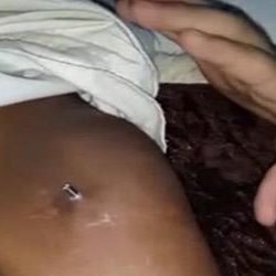 إنقاذ شاب باستئصال كليته المتهتكة