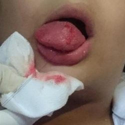 حريق يخلي 340 حاجا هنديا من فندق بالمدينة