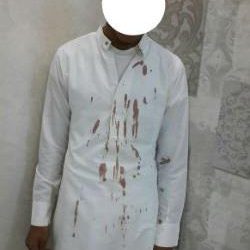قرد يخطف حقيبة حاج تركي في جبل النور ويتسبب في وفاته