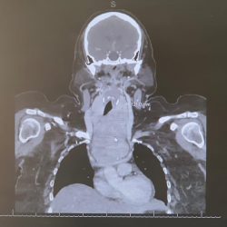 صحة الرياض تستهدف ملاك ومخالطي الإبل بلقاح الإنفلونزا الموسمية