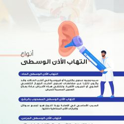 حالة الطقس المتوقعة اليوم الأحد