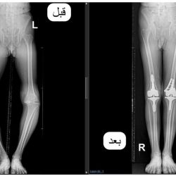 طيران ناس يطلق مركز عملياته الجديد بالمدينة المنورة والرابع بالمملكة ويكشف عن شبكة وجهاته بدءاً من 1 ديسمبر