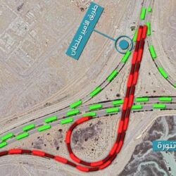 استشاري جراحة عظام أطفال يفند اعتقادات خاطئة ويحذر من مشايات ومهاد الأطفال