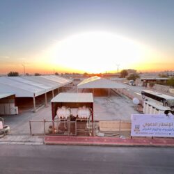 النعيرية العام يجري عملية نوعية لإزالة ورم نادر بالكاحل