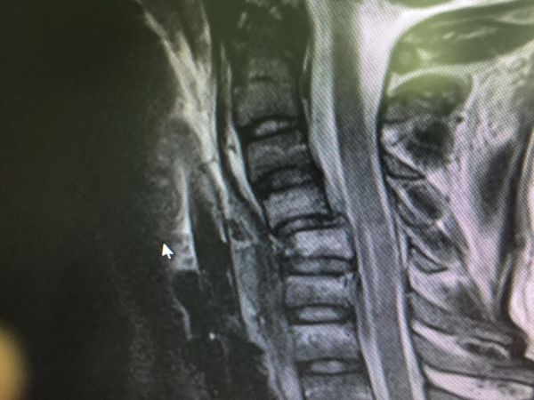 مذكرة تفاهم تجمع بنك التنمية الاجتماعية و كودو