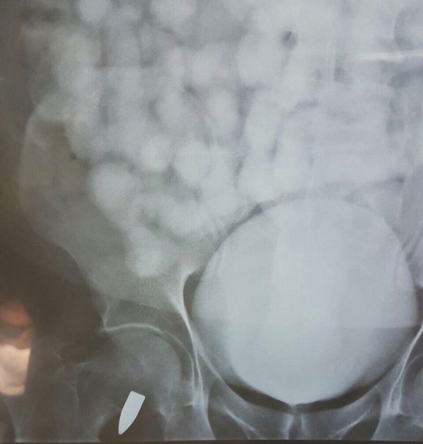 المقوشي يدعو المبتعثين لصناعة صورة إيجابية عن الوطن