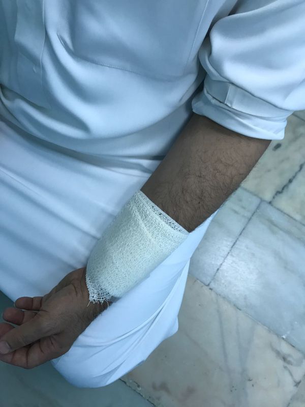 مستشفيات منى تستقبل 10 آلاف حاج يوم العيد
