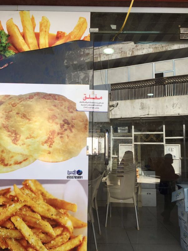 فريق طبي ينهي معاناة مريضة من حصوة بالقناة الصفراوية بالمدينة
