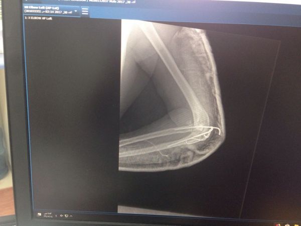 معلق الجيل مسابقة جديدة بميدان فروسية الأحساء