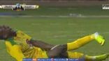 إصابة مروعة للاعب العروبة