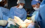 مصادر: وفاة الطفل السيامي اليمني “عبدالله” بعد عملية فصله عن شقيقه
