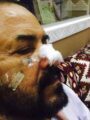 الرياض.. مجهول يطعن “ستينياً” بآلة حادة في أجزاء متفرقة بجسده