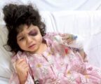 إخراج الرصاصة من رأس زينب