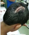 مواطن يتنازل عن مقاضاة خادمة أصابت ابنه بجرح استلزم 9 غرز في رأسه
