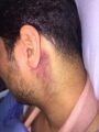 الإطاحة بمواطنَين صعقا ثلاثيناً بصاعق كهربائي بسبب حفل مختلط بمنزل (صور)