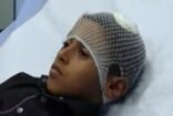 بالفيديو.. والد طالب “ابتدائية” بيش يروي تفاصيل شج رأس ابنه ويعلن تنازله عن المعلم