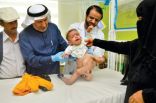 نجاح عملية فصل التوأم السيامي اليمني