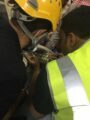 تحرير قطعة معدنية من يد طفلة عمرها ٦ سنوات