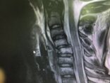 الصحة نجاح عملية جراحية معقدة لشاب في العقد الثاني من عمره