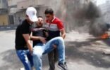 أكثر من 100 مصاب خلال مواجهات في القدس المحتلة