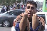 شاب يقطع يديه الاثنتين ليتوب عن السرقة