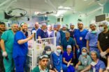 نجاح فصل التوأم السيامي اليمني يوسف وياسين الملتصقين بالرأس بعملية استغرقت 15 ساعة