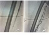 مجمع الملك عبدالله الطبي بجدة يُعيد الحركة لحاجّة