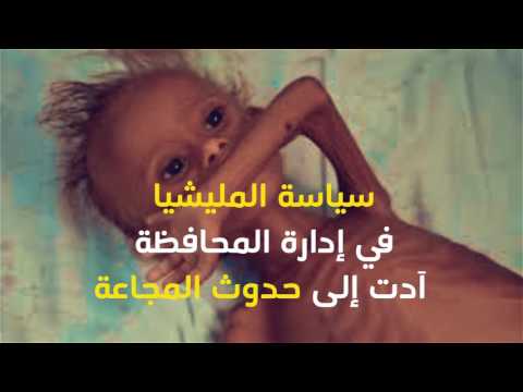 ميلشيا الحوثي وصالح تدمر محافظة الحديدة و تتسبب بمجاعة